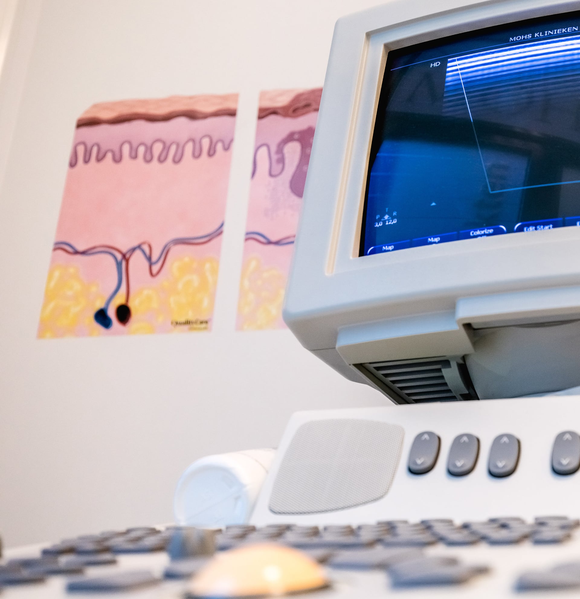 Behandelingen - MohsA Huidcentrum (een focuskliniek van Bergman Clinics)
