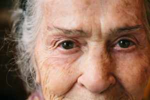 Cosmetische dermatologie - MohsA Huidcentrum (een focuskliniek van Bergman Clinics)